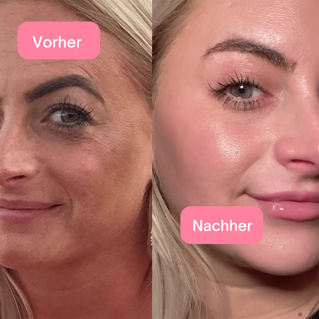 Sakuraglow Koreaanse Collageen Niacinamide Gelee: Ultieme Anti-Veroudering Huidverzorging