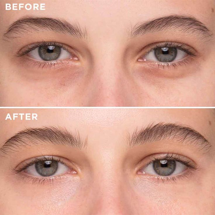 Dermaevo Koffein Augenserum – Energie für deinen Blick