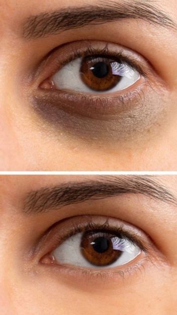 Dermaevo Koffein Augenserum – Energie für deinen Blick