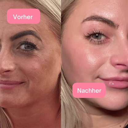 Sakuraglow Koreaanse Collageen Niacinamide Gelee: Ultieme Anti-Veroudering Huidverzorging